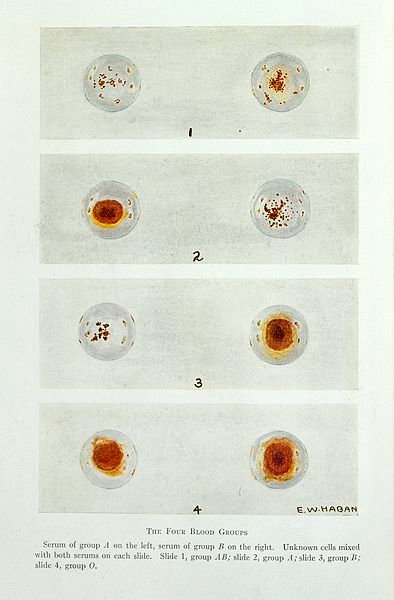 The_four_blood_groups_Wellcome_L0030727.jpg