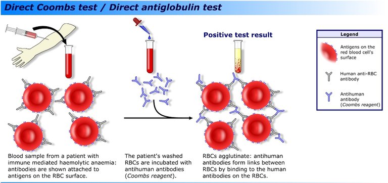 Coombs_test_schematic_1.png