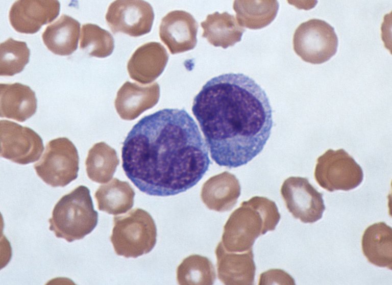 Giemsa stained blood).jpg