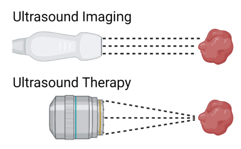 Ultrasound_Imaging_vs._Ultrasound_Therapy.png