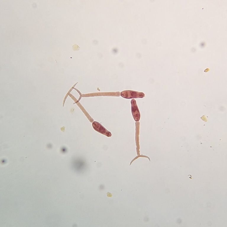 Schistosoma_mansoni_(Cercariae).jpg