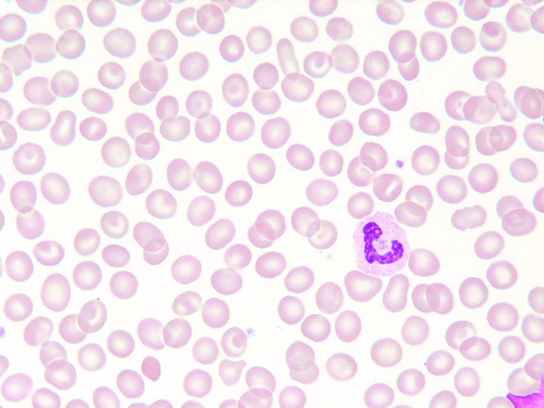 Blood-monocyte.jpg