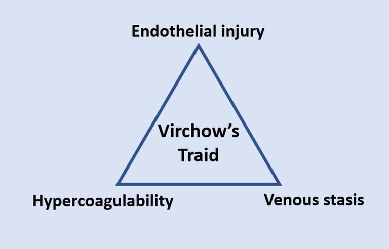 Virchow's_triad.jpg