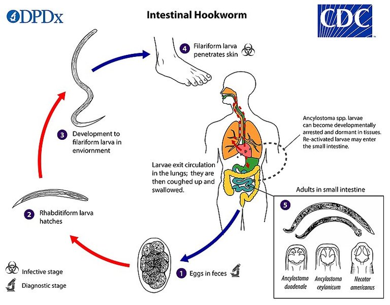 Hookworm larvae.jpg