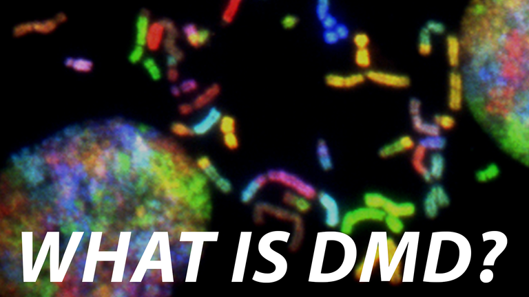 What is DMD?