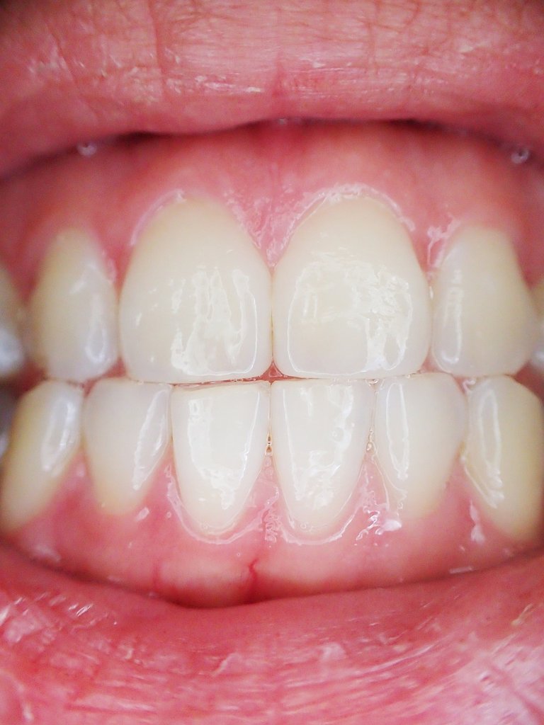 teeth-887338_1280.jpg