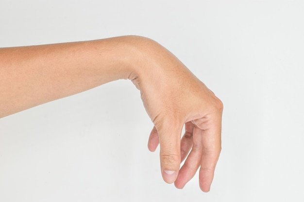 radial-nerve-injury-wrist-drop_778980-227-4181413189.jpg