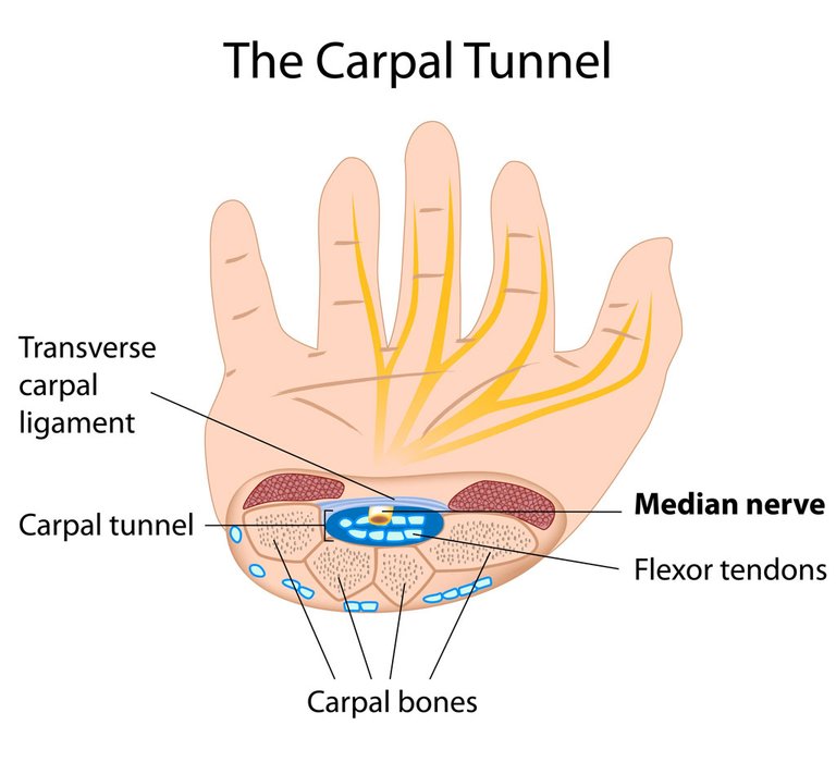 Carpal-tunnel-syndrome-779263028.jpg