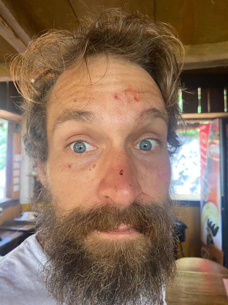 faceAfter.jpg