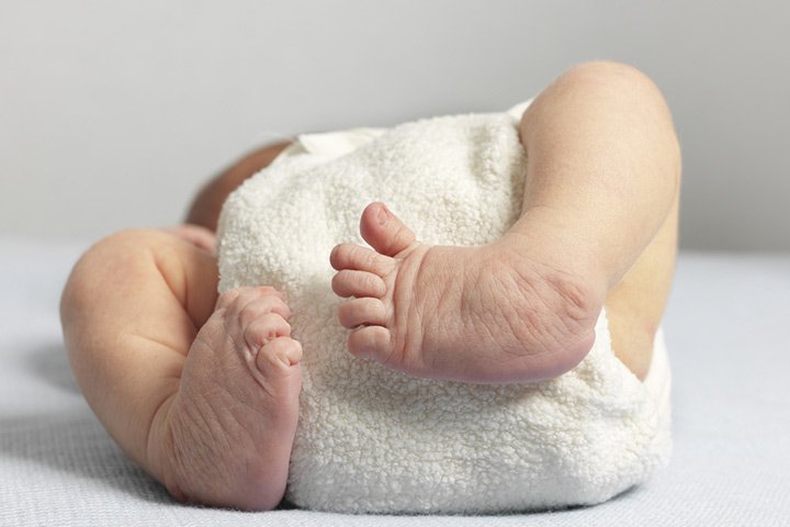 What-Causes-Clubfoot-In-Babies-And-Whats-The-Treatment.jpg