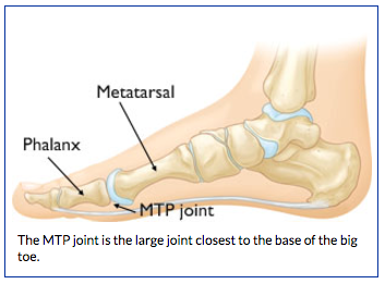 MTP-joint-01.png