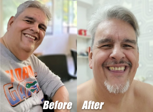 Before-after 2.png