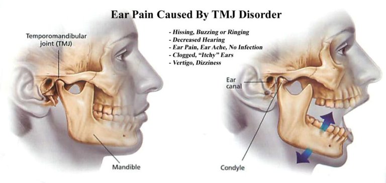 Ear-Pain-1024x485.jpg