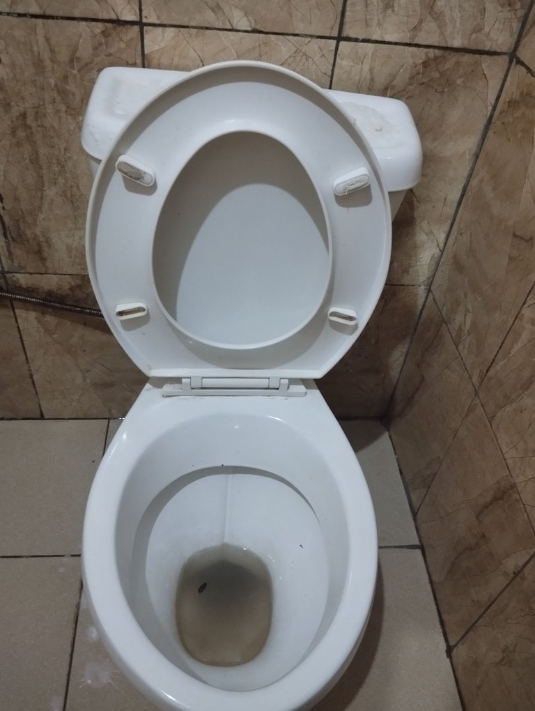 The hidden health risk of a neglected toilet.(Eng/Esp)