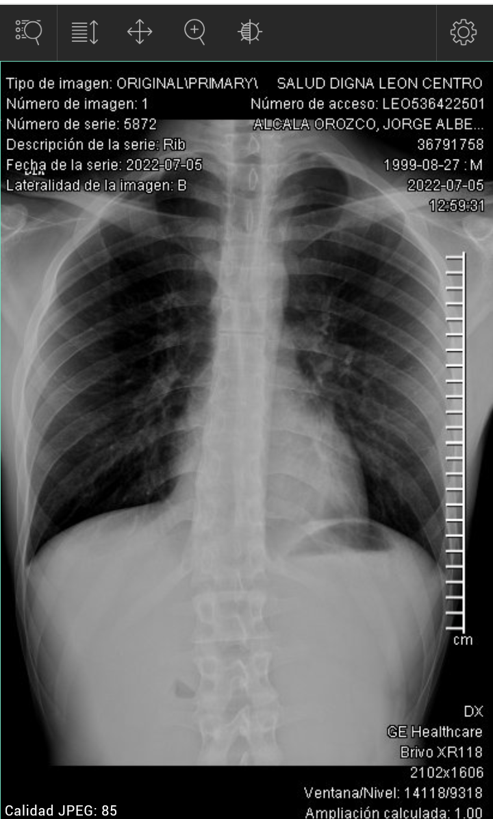 radiografia (2).png