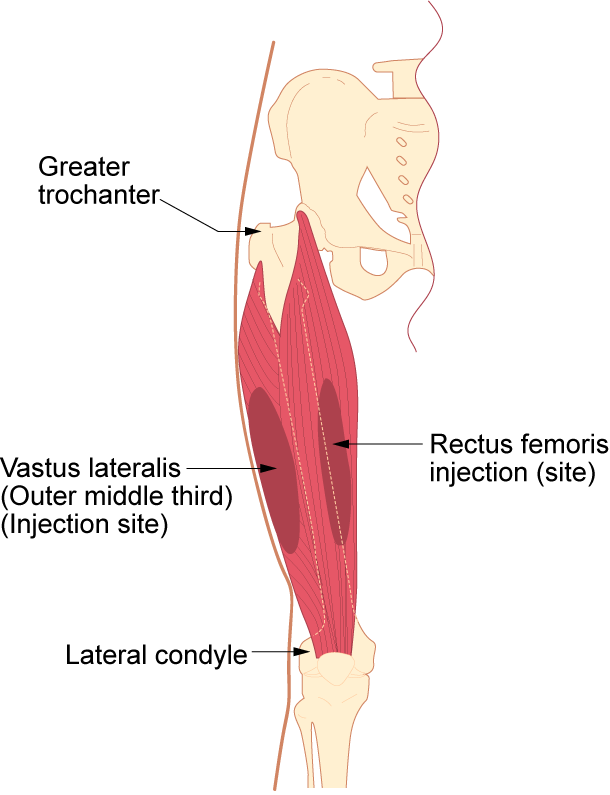 Im-vastus-lateralis.png