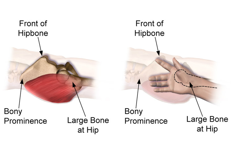 Injection_Sites_Intramuscular_Hip.png