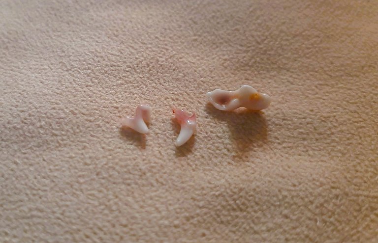 Anyongi's Baby Teeth.jpg