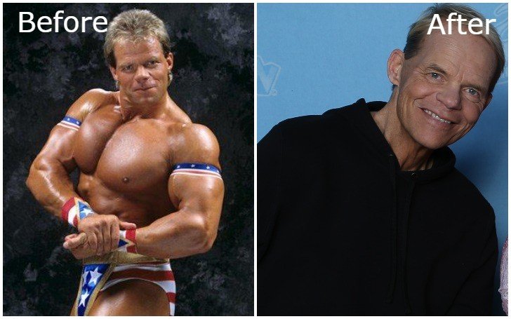 Lex-Luger-Weight-Loss-is-trending-His-wrestling-career-and-more-info.jpg