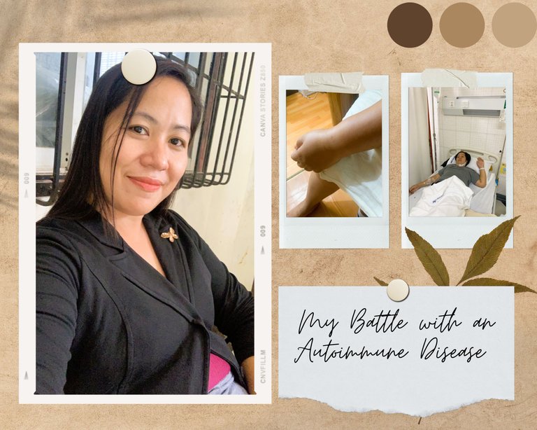 The Pain Beneath My Bones: My Battle with an Autoimmune Disease (RA)