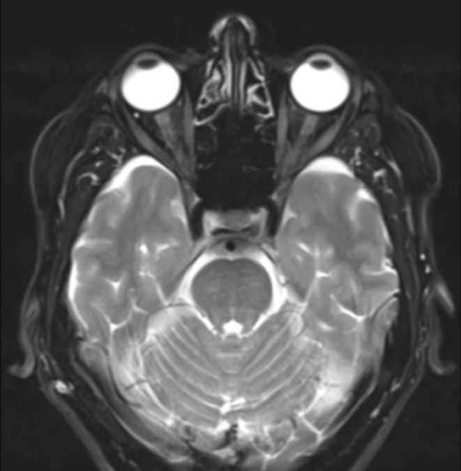 MRI Slice.jpg
