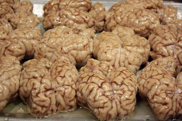 brains-2431047__480.jpg