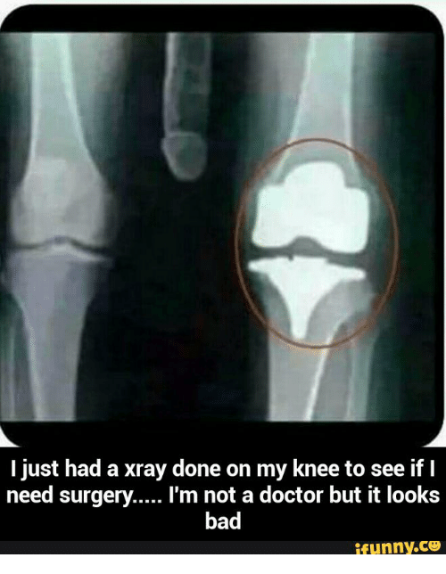 just-had-a-xray-done-on-my-knee-to-see-18260566.png