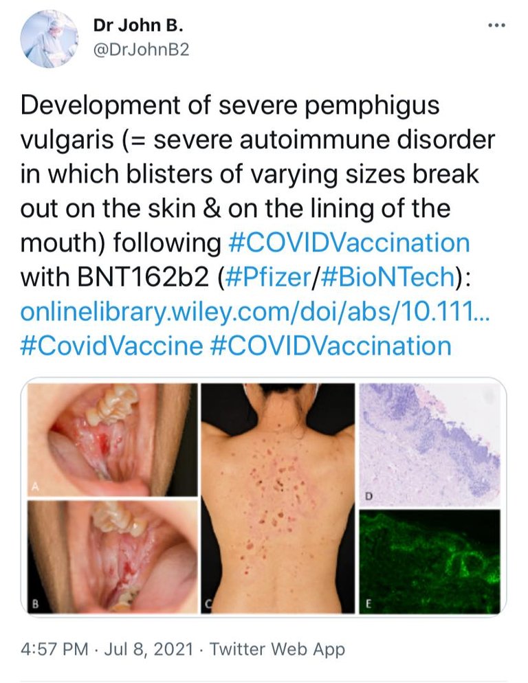 vax skin 10.jpg