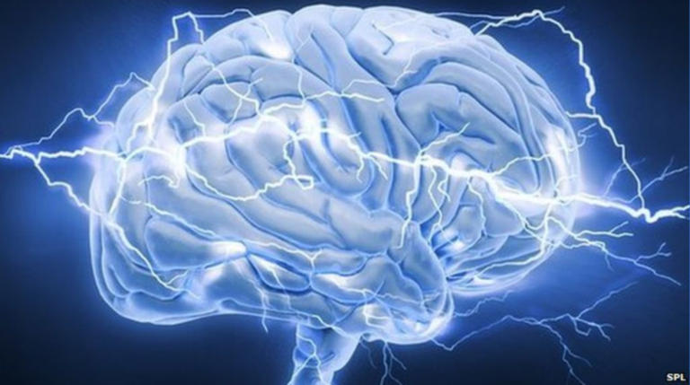 electric-brain-768x429.png