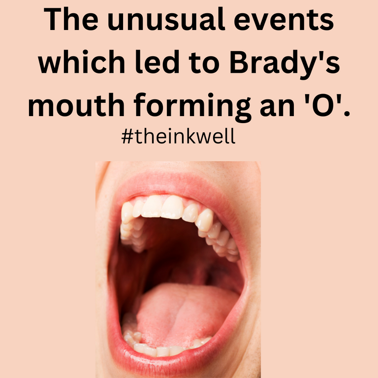 The unusual events which led to Brady's mouth forming an 'O'..png