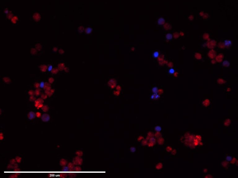 HL60+rfp+dapi.jpg