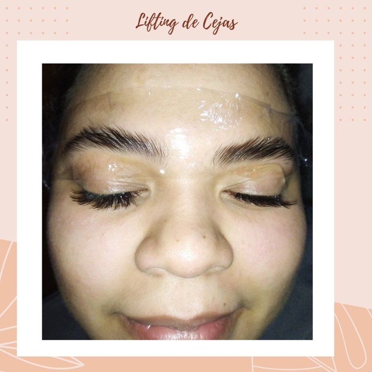 Lifting de Cejas (1).jpg