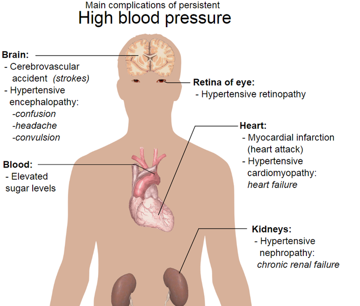 705px-Complications_of_hypertension_whitebackground.png