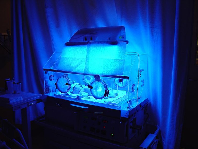 800px-Pasha_in_incubator_with_blue_light_-_Flickr_-_SilentObserver.jpg