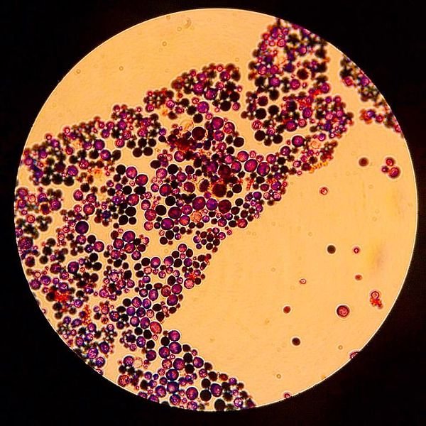 Candida_albicans_(optic_microscope).jpg