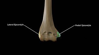 320px-Medial-epicondyle-and-lateral-epicondyle.jpg