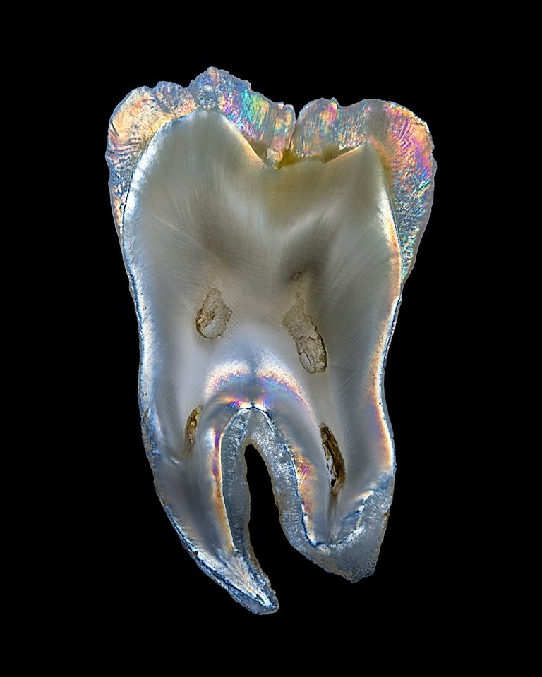 tooth1280.jpg