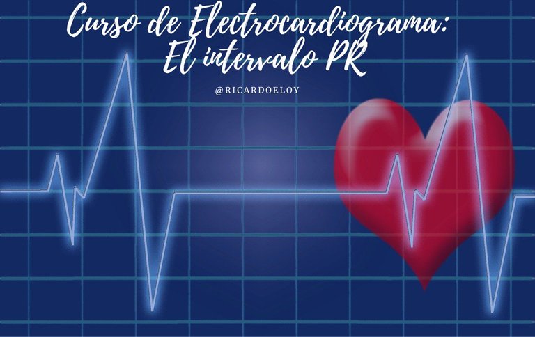 Curso de Electrocardiograma El intervalo PR.jpg
