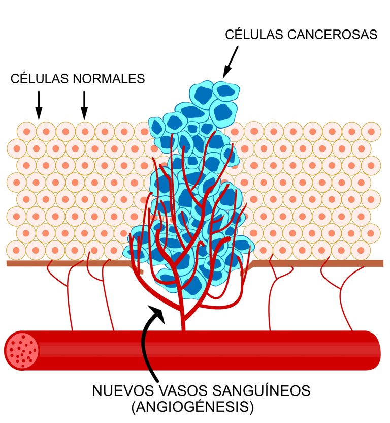 Angiogenesis.jpg
