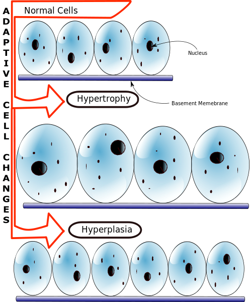 497pxHyperplasia_vs_Hypertrophy.svg.png