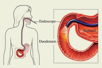 endoscope.jpg