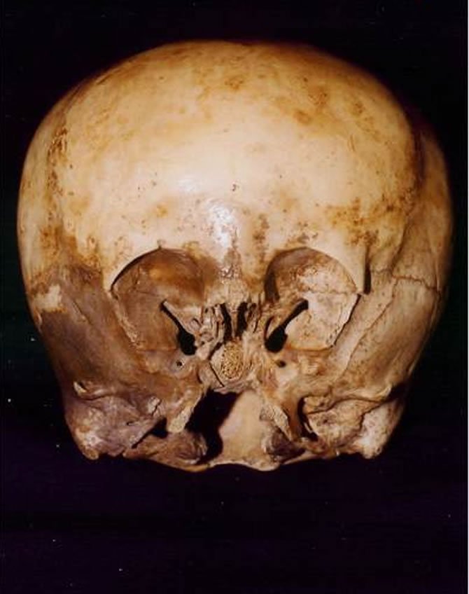 Starchild_skull_1.jpg