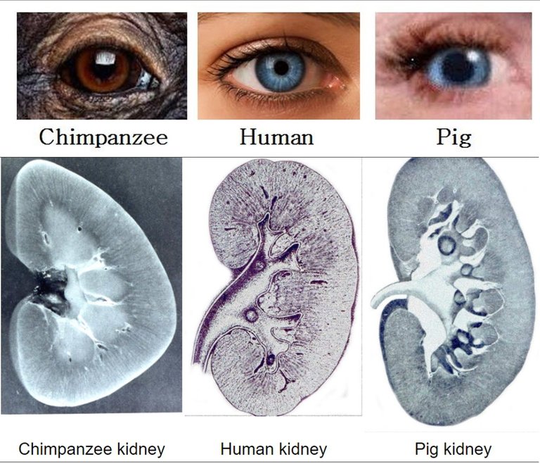 Pigs_Hamlet_Pig_Human_Eyes_Kidney.jpg