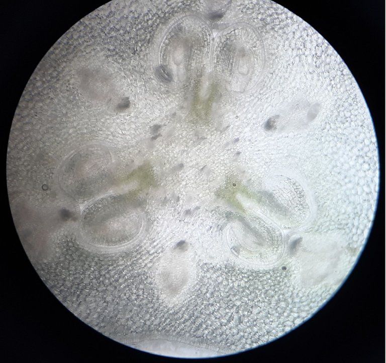 Cross section of the ovary