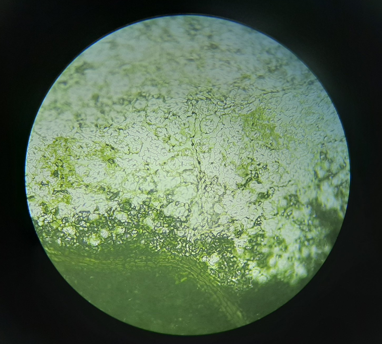 Stomatal cells when viewed below 10x