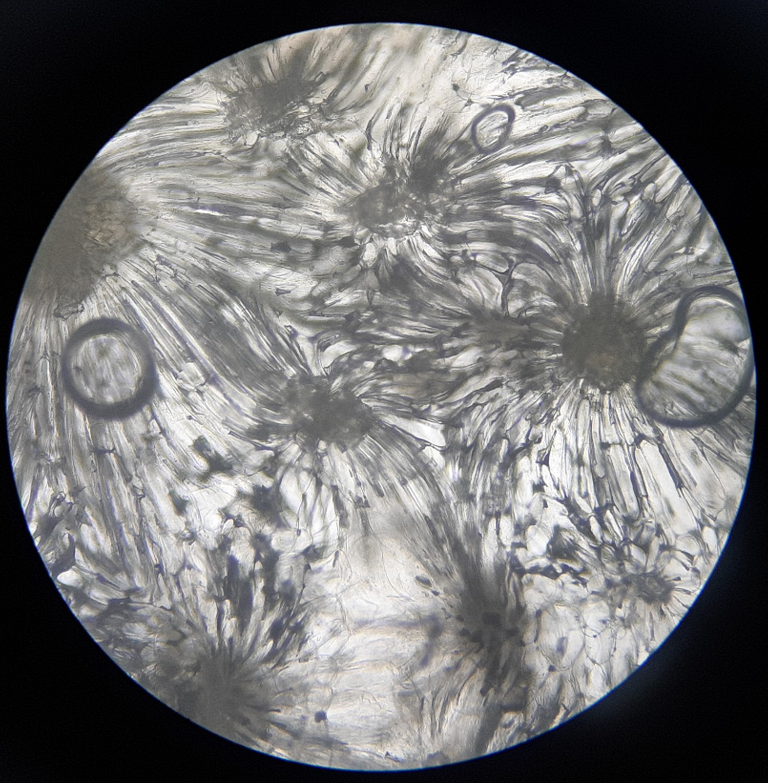 The hard tissue cells of guava