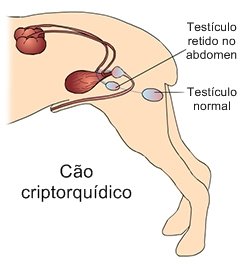 cryptorchidism.jpg