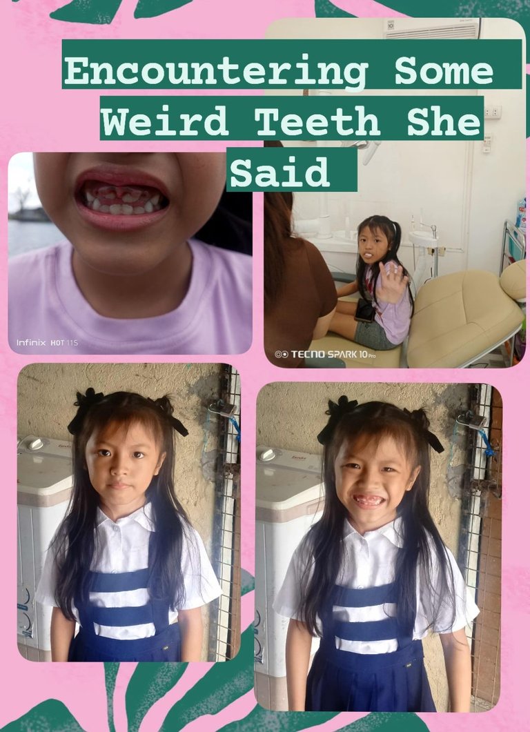 Encountering Some Weird Teeth She Said 