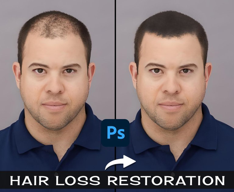 Hair-Loss-Restoration-In-Photoshop.jpg