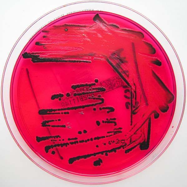 600pxSalmonella_species_growing_on_XLD_agar__Showing_H2S_production.jpg